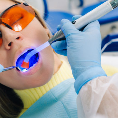 Setting white fillings in the City of London